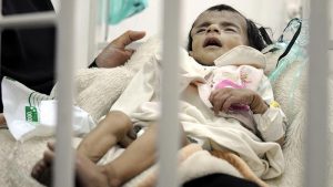 Yemen’de Her Yıl 66 Bin Çocuk Ölüyor