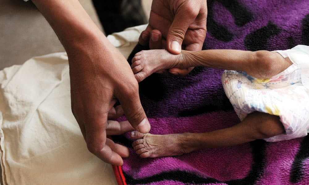Unutulmaya Yüz Tutan En Büyük İnsani Kriz: Yemen