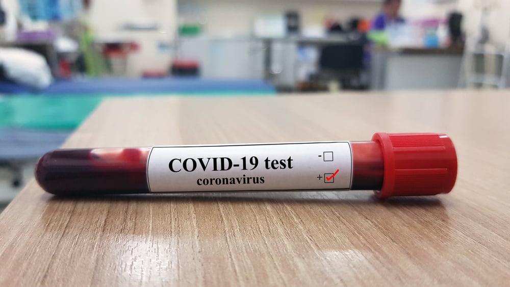 Covid-19