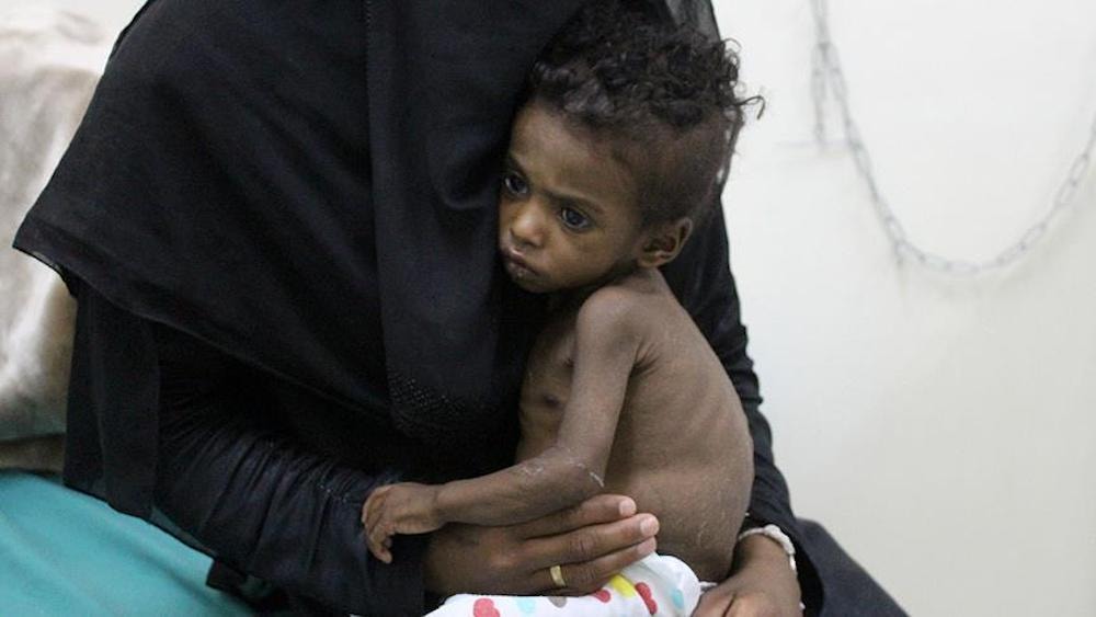 Yemen kıtlık