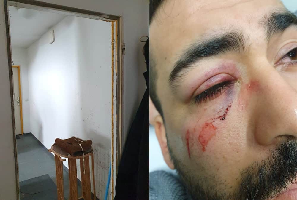 Yanlış Adres Kurbanı Oldu, Alman Özel Kuvvetleri Tarafından Darbedildi