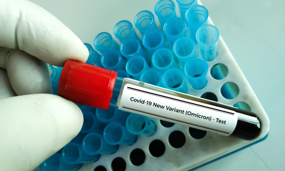 Omicron Varyantı Haftalar Öncesinde Avrupa'da Olduğu Belirlendi