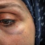 “Siz Başörtülüler Buraya Ait Değilsiniz! Ülkenize Gidin!”