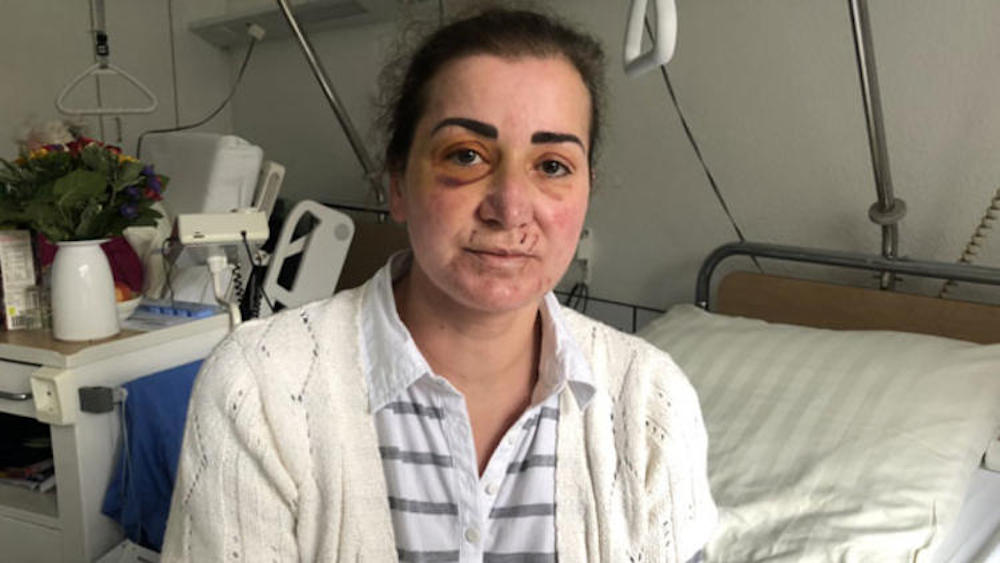 türk kadın saldırı