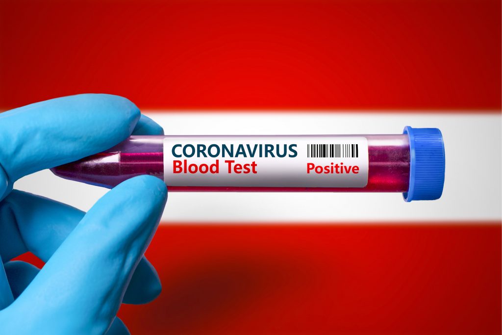 Avusturya Başbakanı: “Rus ve Çin Kovid-19 Aşılarını Ülkede Üretmek İstiyoruz”