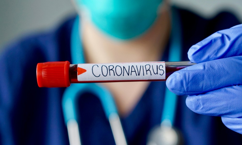 Koronavirüs Testi