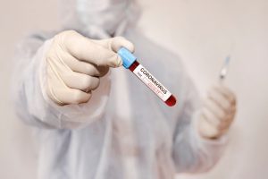 Belçikalı Virolog: “Virüsün Türlerinin Ortaya Çıkması Normal”