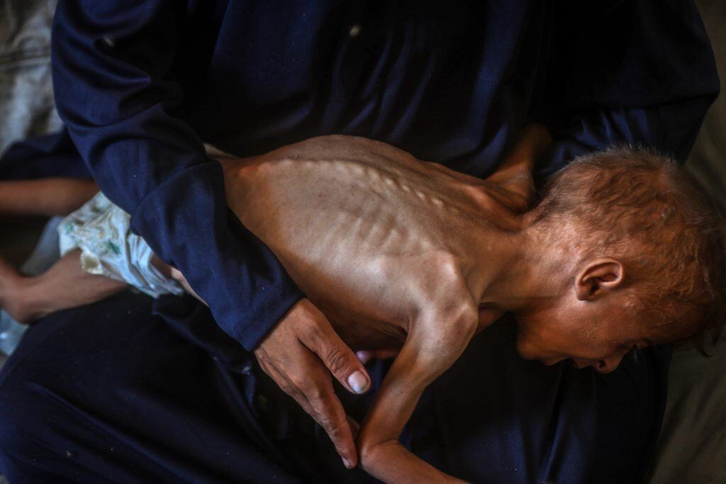 “Gazze’de Ölüyoruz Çünkü Kimse Yaşamamıza İzin Vermiyor”