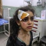 “İsrail Gazze’de Çocukları Sistematik Olarak Hedef Alıyor”