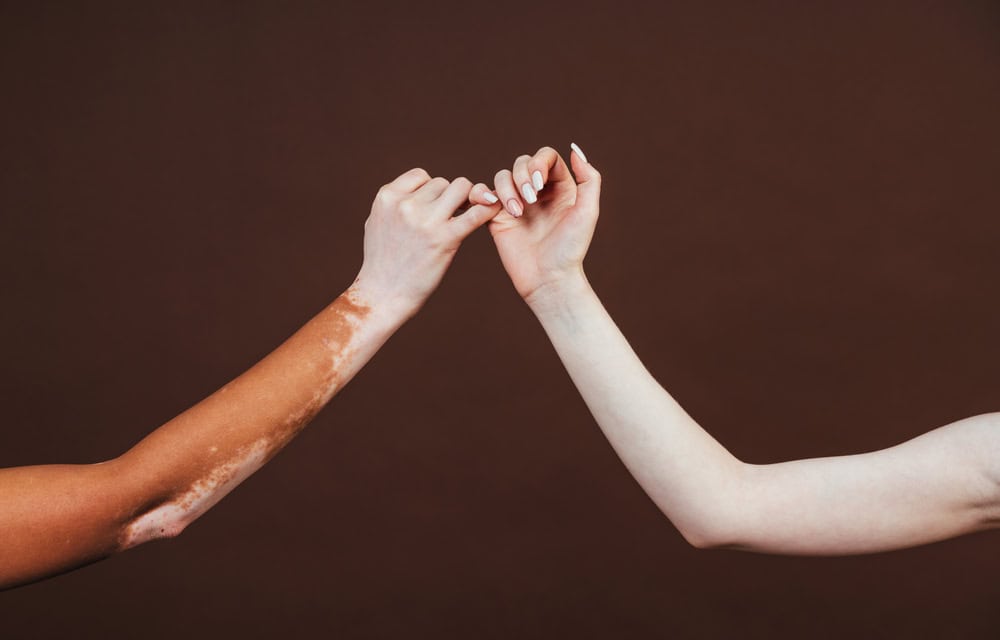 Ten Rengi ve Dış Görünüşe Göre “Beyaz Sayılmak”: White Passing Nedir?